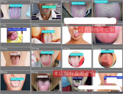 7892-^̦zyYOLO(sh)(j)ģ1472 5