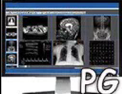 8892-Sante PACS Server PG v4.2.2 ° t(y)Ӱ惦(ch)ϵy(tng)(w)ܛ bԃ(w)